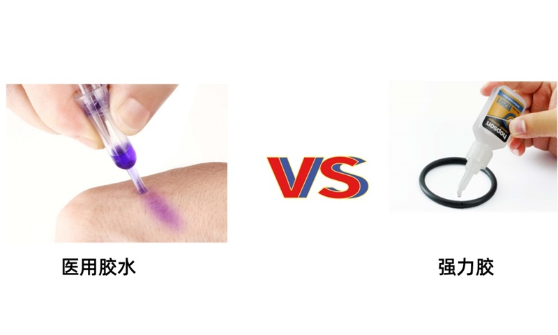 医用胶水与502瞬干胶一样吗？