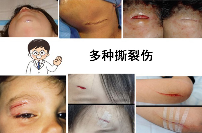 Various-Lacerated-Wounds.jpg