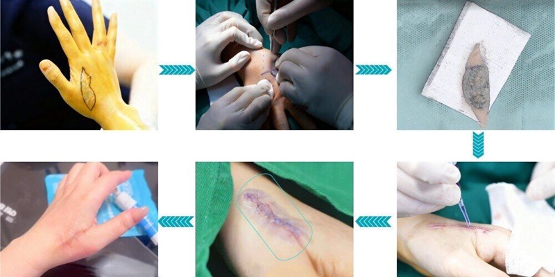 液体创可贴：随身“小绷带”，轻松应对小伤口